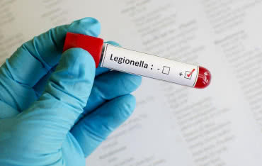 Bakteria Legionella - objawy zakażenia i profilaktyka